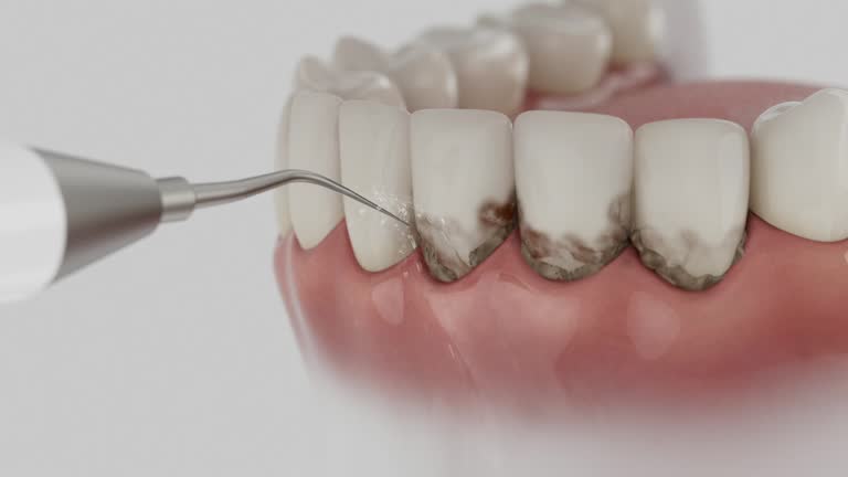 Trusted Dental Crowns And Bridges service in Dover, AR - Dentist Open Now